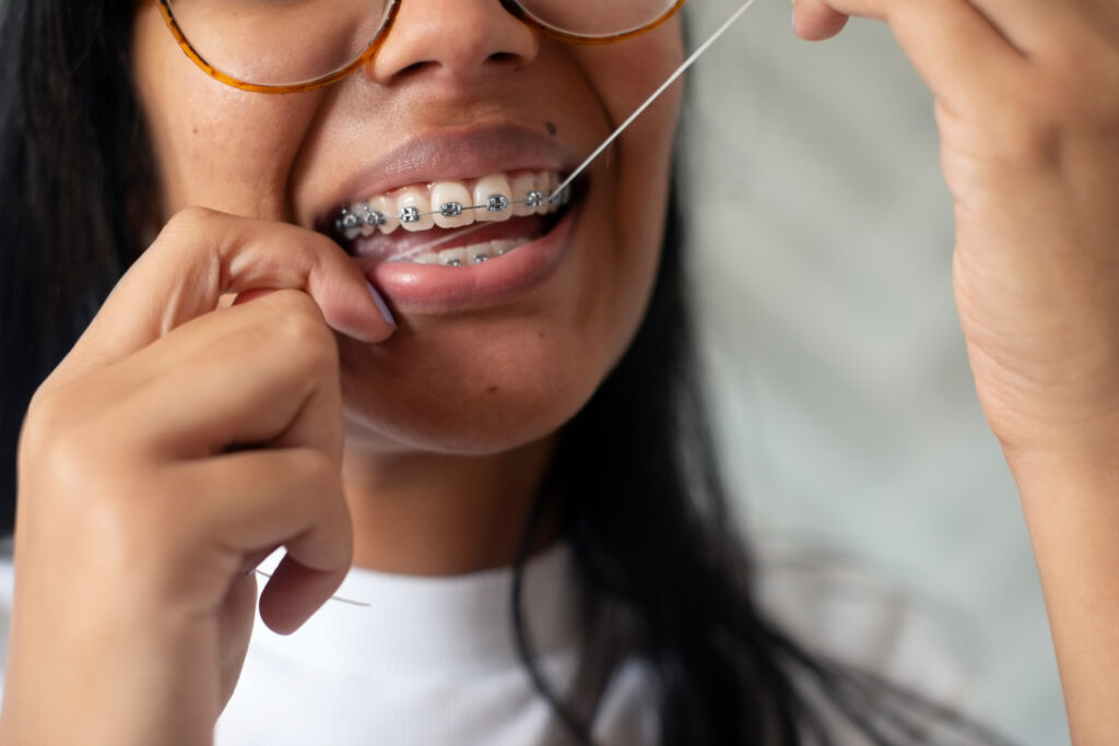 Braces, Floss And Closeup Of Woman With Dental Health, Wellness Or Hygiene Morning Routine. Smile, Dentistry And Zoom Of Young Female Person Cleaning Teeth For Fresh Oral Mouth Treatment At Home.