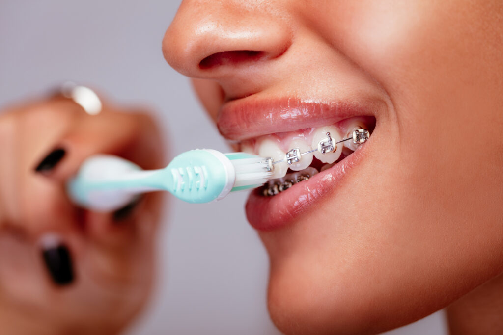 Brushing Teeth With Braces